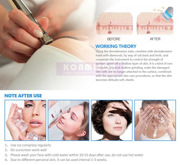 Portable Good Looking Facial Care Microdermabrasion Therapy