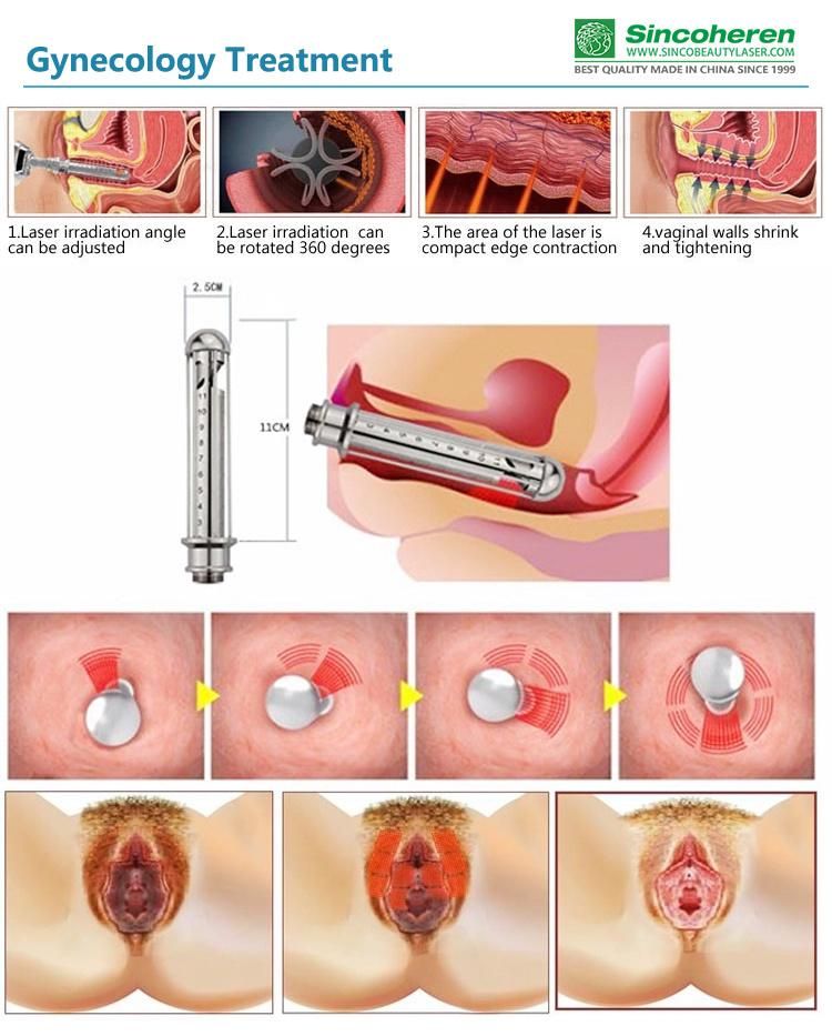 RF Metal Tube Laser CO2 Fractional / Fractional CO2 Laser Vaginal Tightening Machine