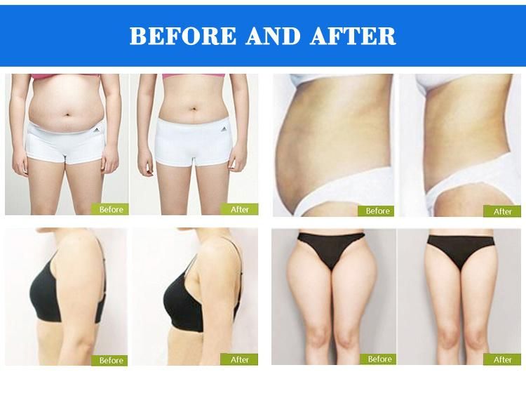 Veritical Multifunctional Cavitation RF Lipolaser Cryo Lipo Weight Loss Machine