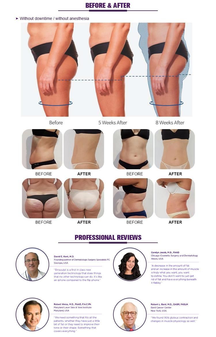 Non-Surgical Body Sculpting Build Muscle Burn Fat Painless ABS Butt EMS