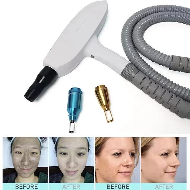 Portable ND YAG Laser Tattoo Removal