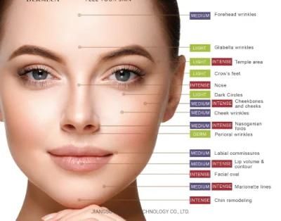 Cross-Linked Dermal Filler Hyaluronic Acid Injectable Dermal Fillers 2ml Chin and Nose Contour