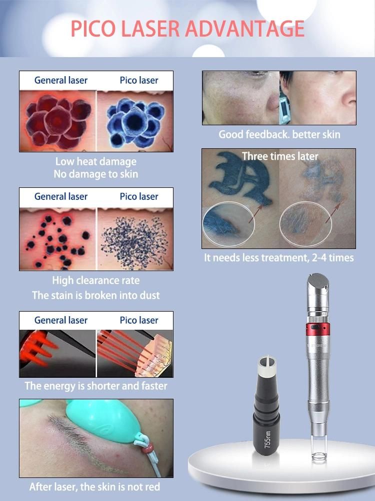 Picolaser Dark Spot Removing Tattoo Acne Removal Q Switched ND YAG Laser Picosecond Laser