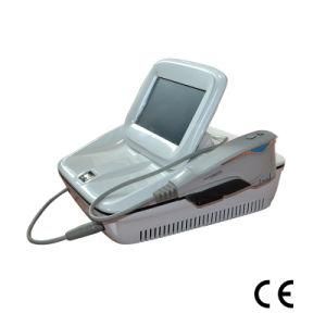 2D Hifu Portable Hifu Machine 2ND Generation (2D HIFU)