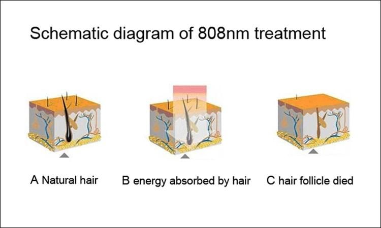 Diode Laser Hair Care Machine ADSS Grupo