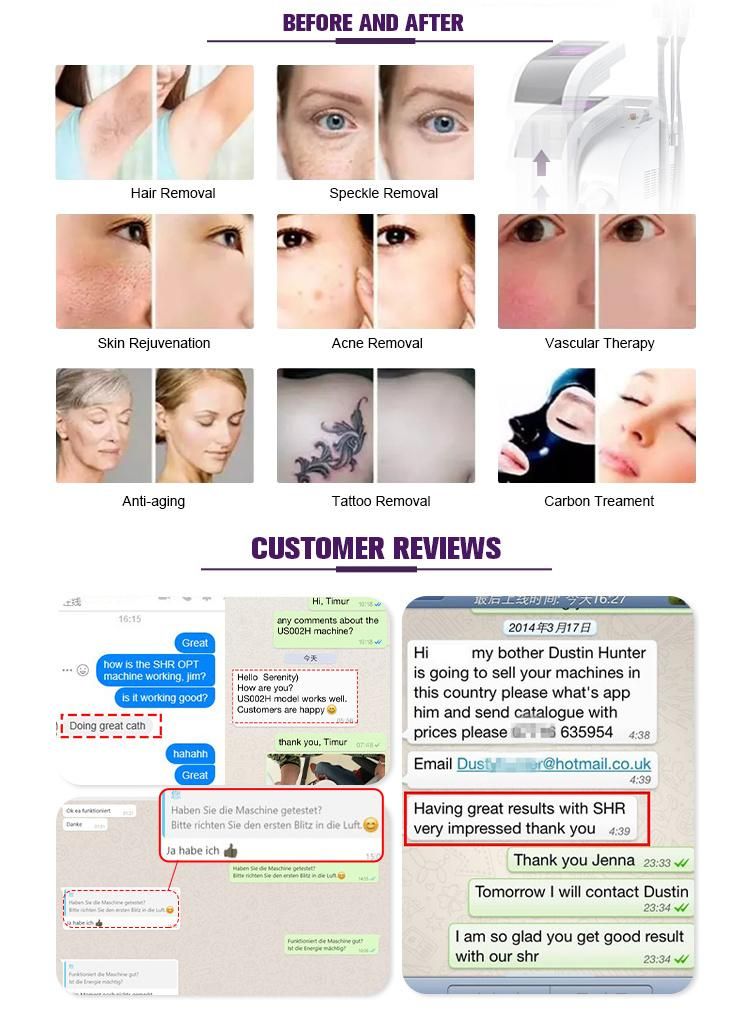 3 in 1 IPL Shr RF Opt YAG Laser IPL Hair Removal E Light Skin Rejuvenation Whitening Tattoo Removal Multifuctional Beauty Equipment