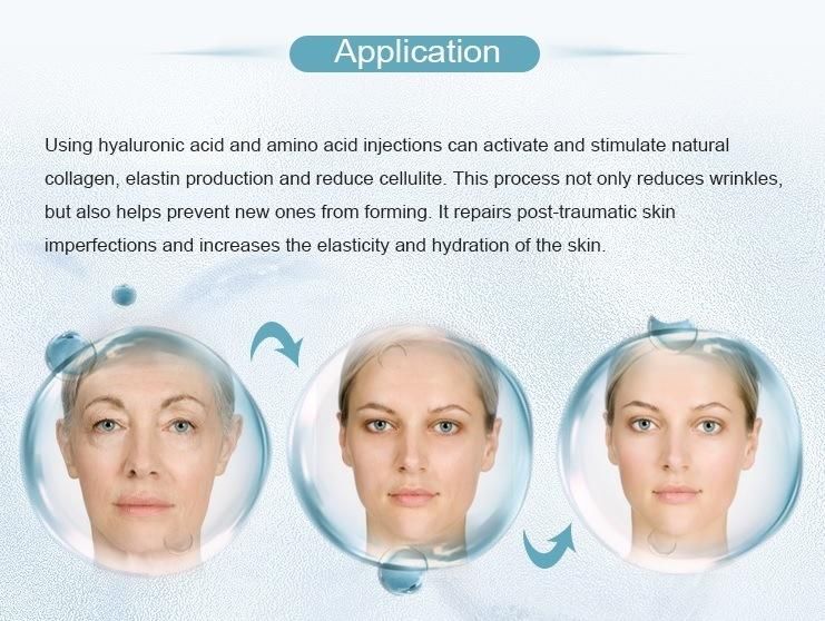 Anti Pigmentation Mesotherapy Solution Ha for Skin Brightening Injections