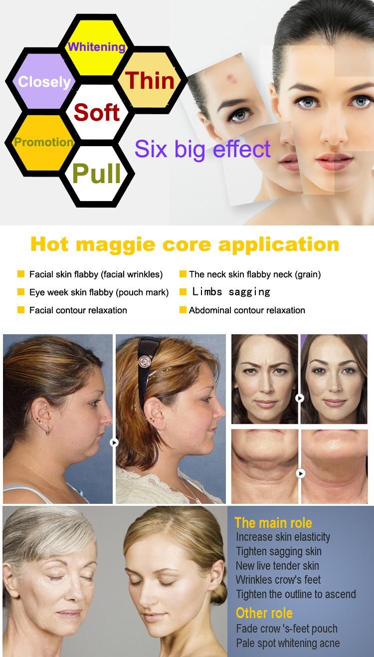 Factory Wrinkle Removal RF System Thermagic Machine for Skin Lifting