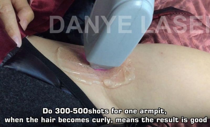 808 808nm Laser Hair Removal Diode laser Epilasyon Makinesi Fiyat Popular in Turkey