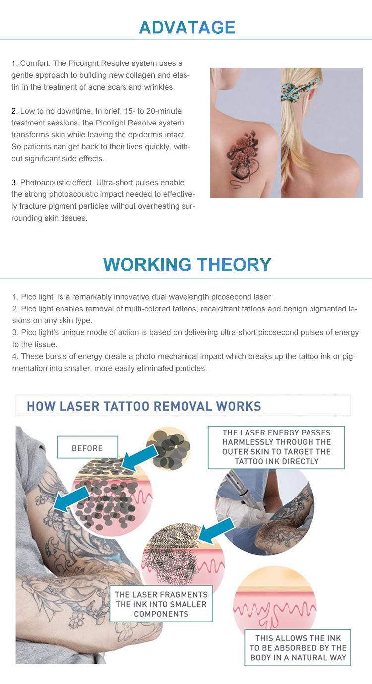 ND YAG Laser Tattoo Removal / Picosecond Laser for Tattoo Removal Skin Whitening