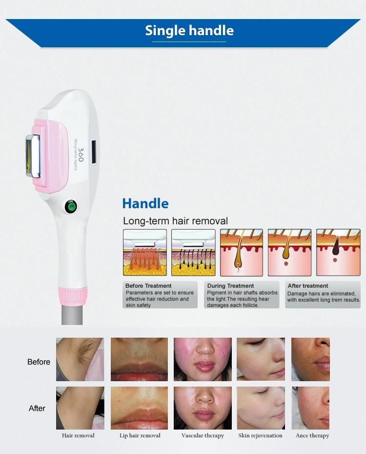 Factory Promotion Price Hot Selling IPL Hair Removal Beauty Machine Shr