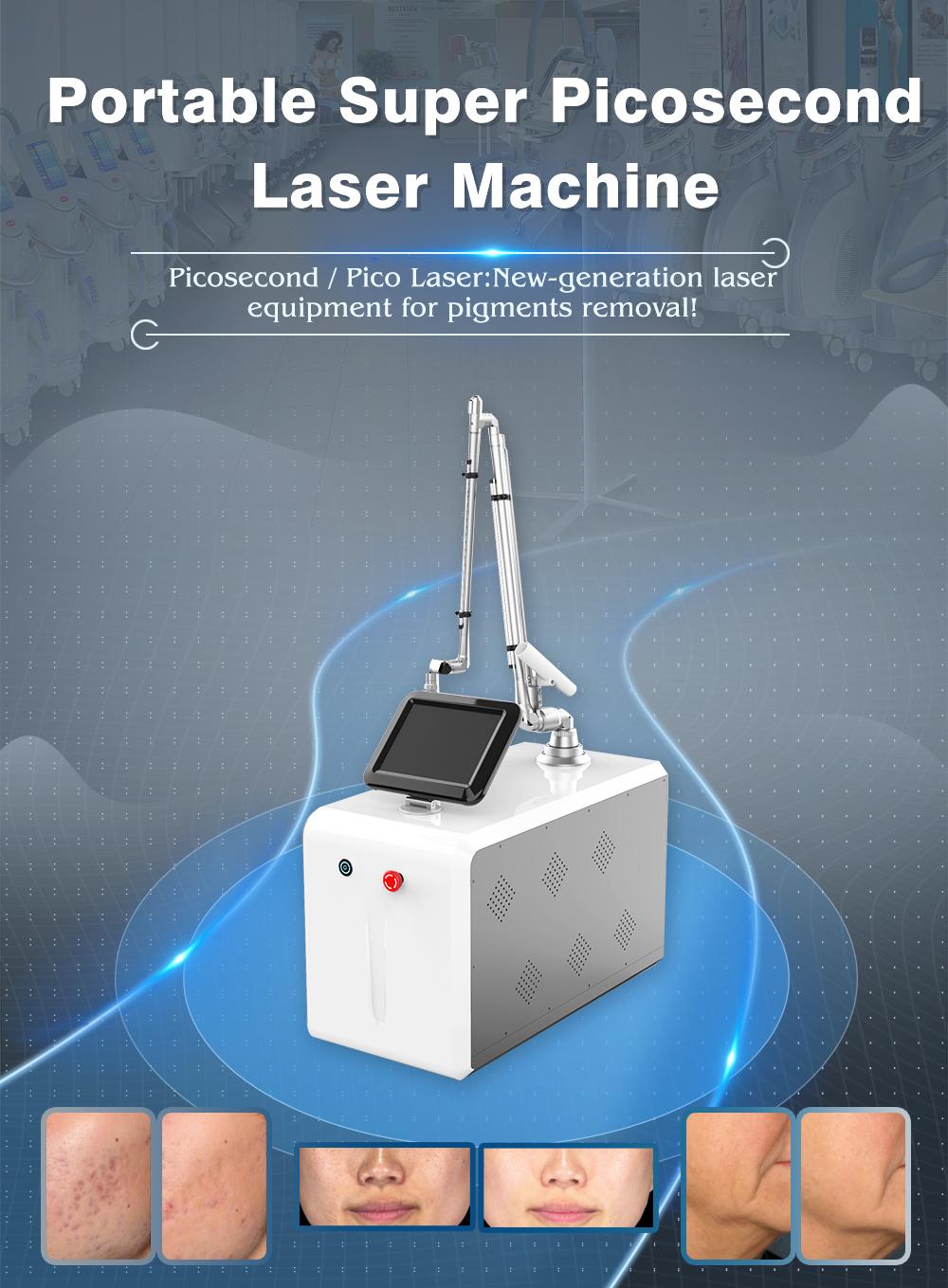 Portable Picosecond Laser Removal Tattoo Machine ND YAG Pico Laser Machine