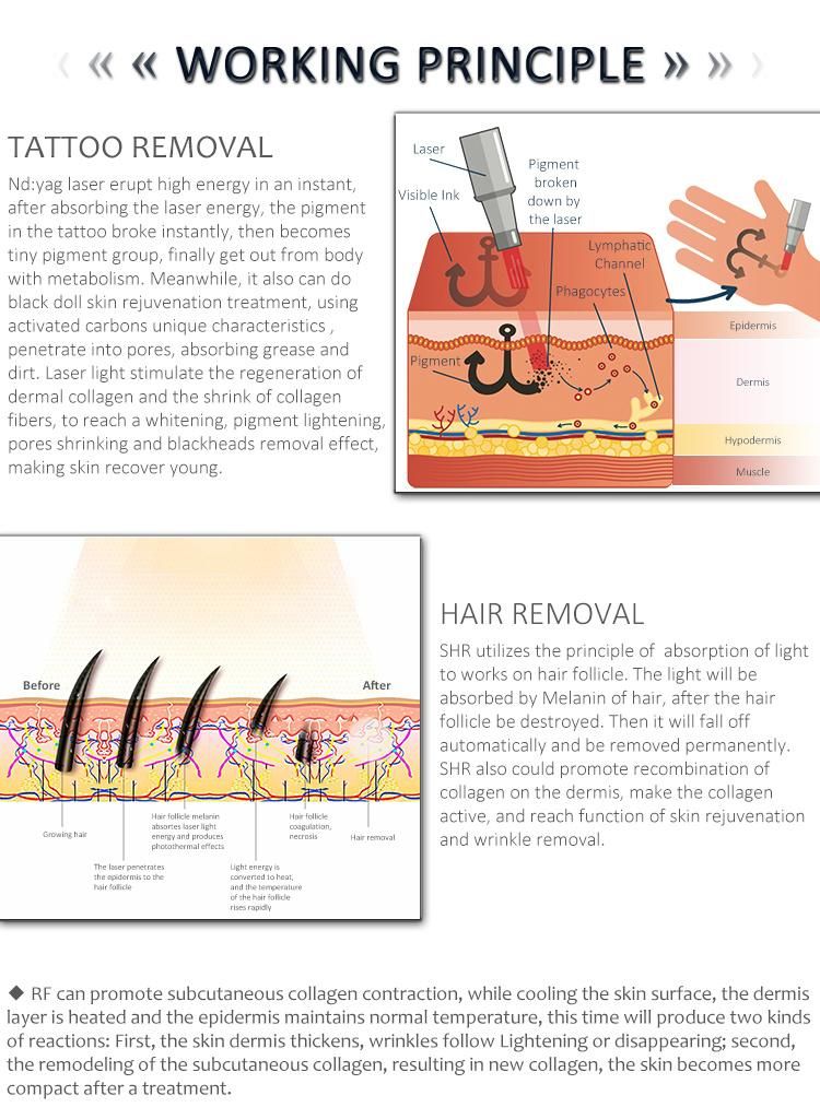 IPL RF ND YAG Laser 3 in 1 Multifunction / E-Light IPL RF+Opt Shr ND YAG Laser Hair Tattoo Removal Machine Beauty Machine