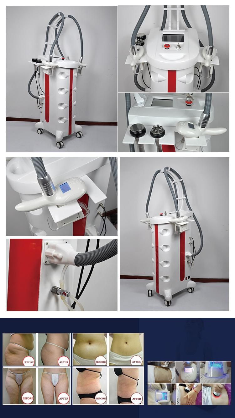 Wholesale Fat Freeze Slimming Machine Cryolipolysis for The Body Cellulite Reduction Machine