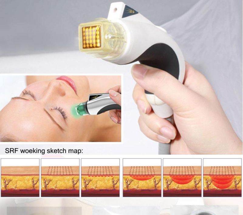 No-Needle RF Fractional Skin Tightening Machine