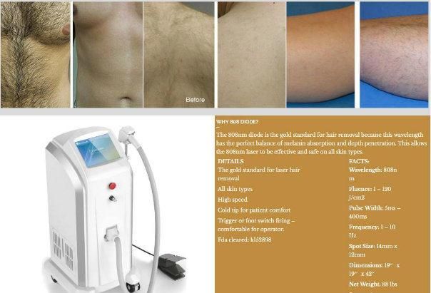 Beauty Salon Machine Sincoheren Beijing New Product Aesthetic Machine 808nm Diode Laser Hair Removal