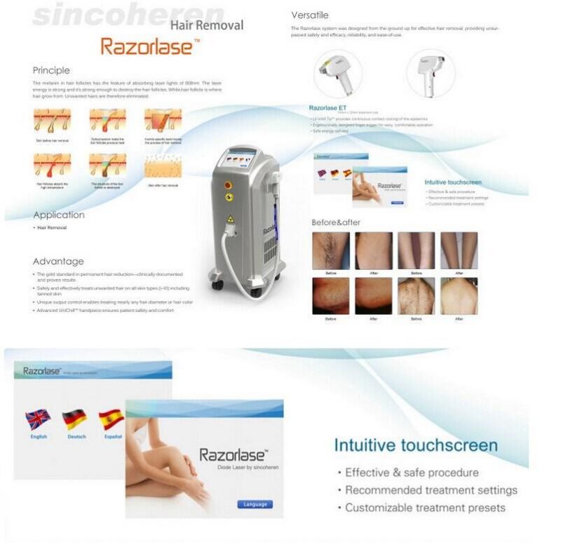 2018 New Factory Price Clinically Proven Effective 808nm Diode Laser Hair Removal Machine