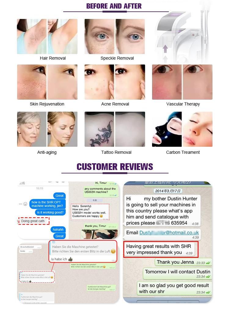 2020 Trending Product Shr/IPL Permanent Hair Remover