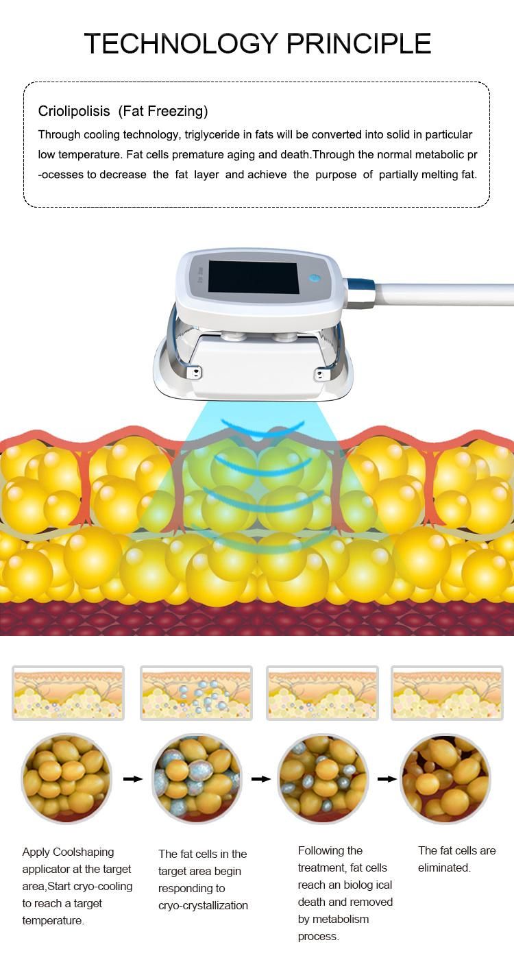 2021 China Manufacturer Four Cryolipolysis Machine for Sale/Criolipolisis Machine Cryolipolysis