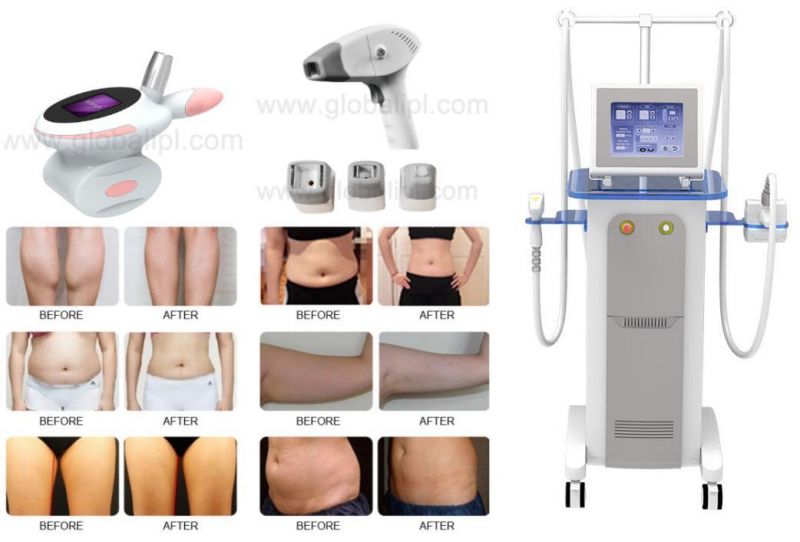 Body Circumference Reduction RF Vacuum Fast Slimming System Beauty Apparatus