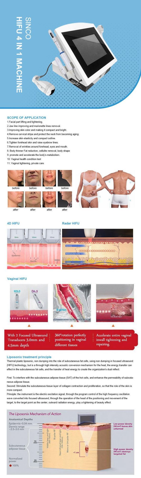 4D Vmax Hifu Face Lifting Liposonix Slimming Machine Vaginal Cirugia