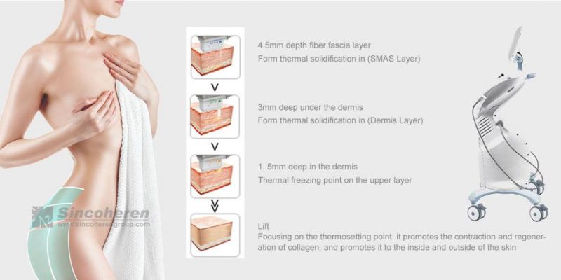 7D Hifu Face Lifting Anti-Wrinkle Machine, Hifu Smas Skin Tightening Machine