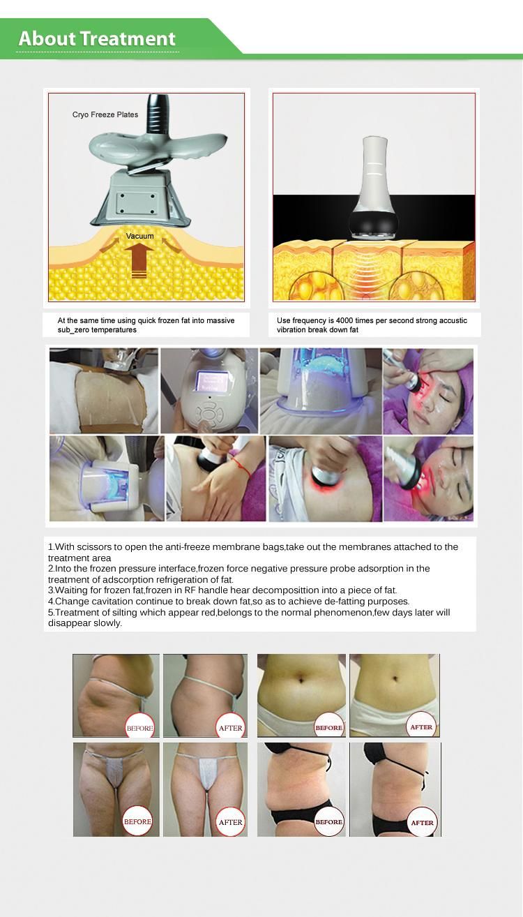 40K Cavitation Cryolipolysis Freezing Body/Facial/Eye RF Fat Beauty Equipment