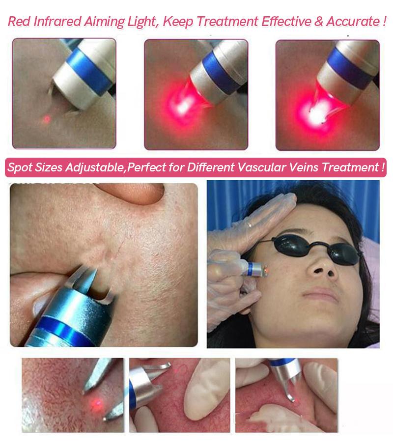 Portable 980nm Diode Laser Vascular Therapy Machine