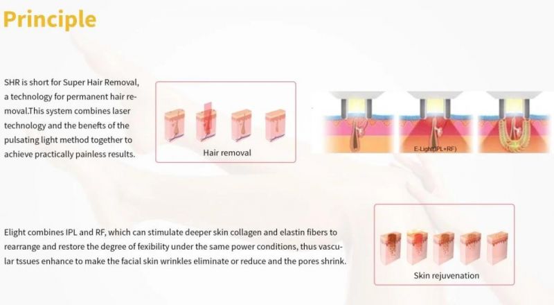 Professional Laser Hair Removal/IPL Opt Hair Removal Machine