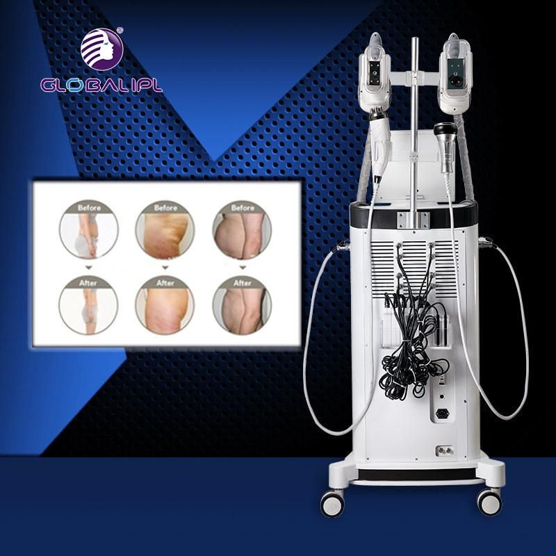 Cavitation Vacuum Ultrasound Body Sculpture Machine with FDA Approval