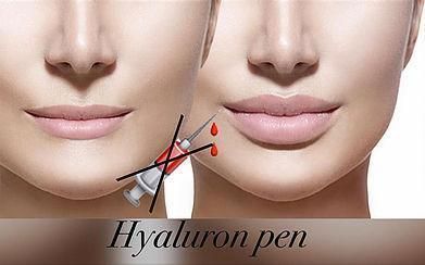 New 24K Gold Serum Adjustable No Needle Injection Hyaluronic Serum Pen for Lip Shape