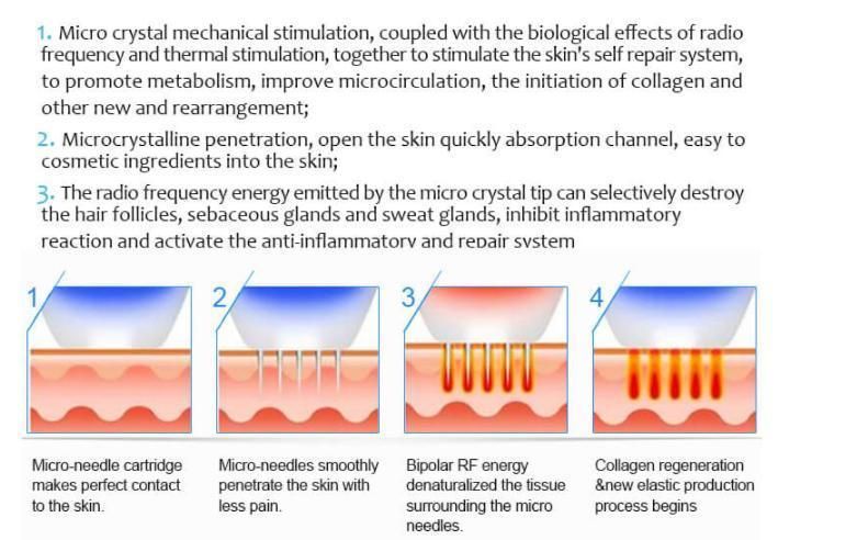 Fractional Microneedling Skin Care RF Machine for Medical Equipment Acne Scar Stretch Marks Removal