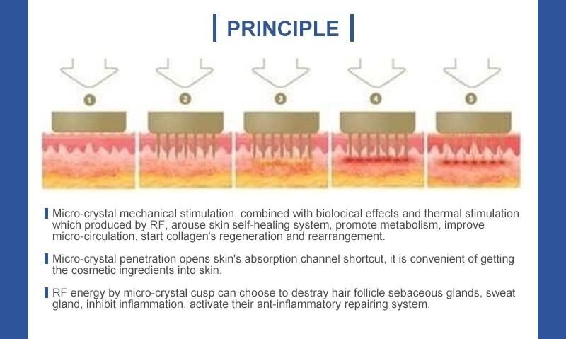 Newest Micro Needle Fractional Golden Microneedling for Acne Scars Removal