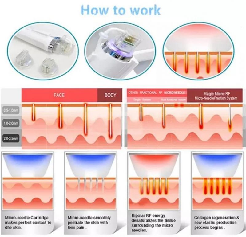 Professional Microneedling RF/RF Skin Rejuvenation Machine