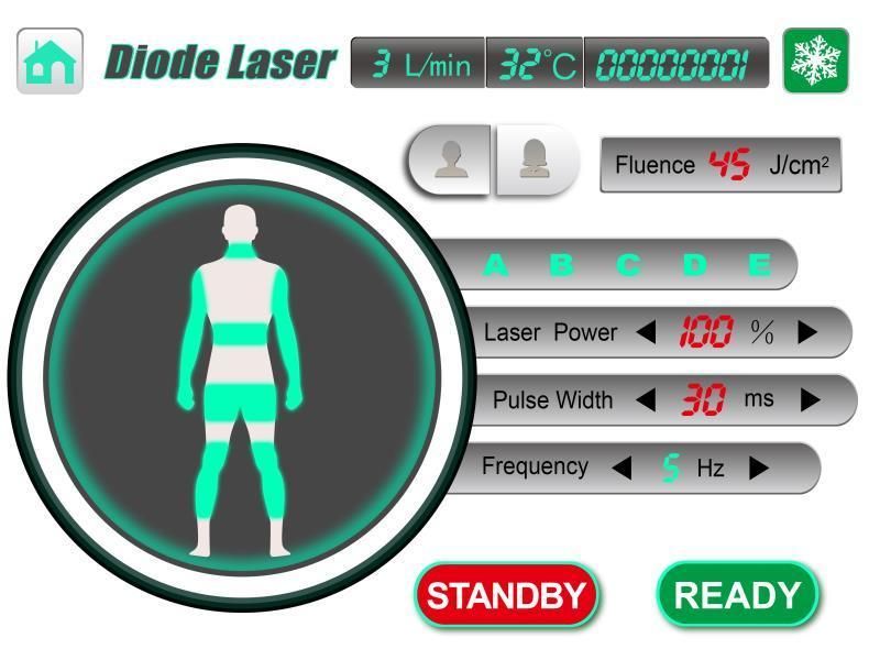 Soprano Platinum Laser Diode Laser Hair Removal 808nm 755nm 1064nm Diode Laser Hair Removal Machine