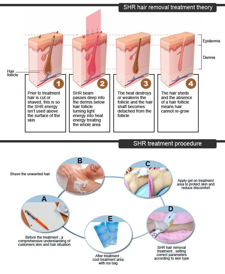 Km Opt System Fast Hair Removal/Skin Rejuvenation Elight Shr