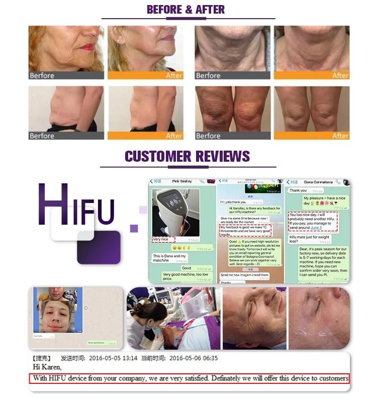 Hifu Fat Slimming Wrinkle Removal Face Lifiting Hifu Ultrashape Beauty Machine