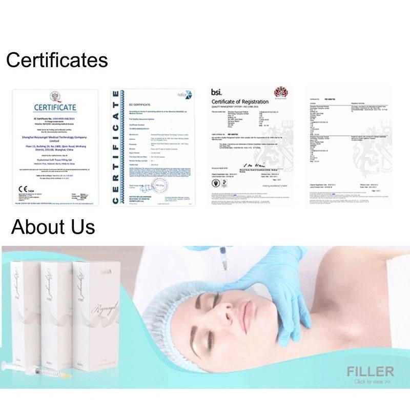 High Quality CE Certified Hyaluronic Acid Dermal Filler