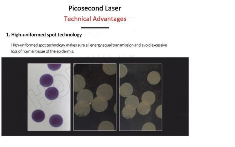 Picosecond Laser Pen Light Therapy Melasma Tattoo Skin Toning Removal Pico Laser Esthetic Salon Machine