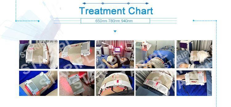 Diode Laser Machine Lipolaser Machine Beauty Equipment Slimming Machine Medical Equipment Beauty Salon Equipment 5D Lipo Laser Lipolaser Slimming Machine