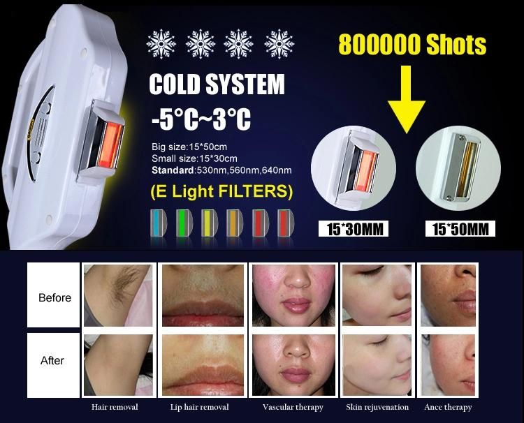 Hot Popular Shr Elight IPL ND YAG Laser RF 3 In1 Beauty Machine