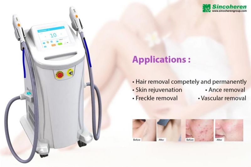 Vertical Professional Two Handles Ance Pigment Removal Dpl Opt Big Spot Size IPL Laser Hair Removal Machine Laser