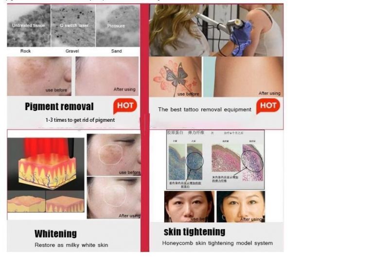 Picosecond Laser Pen Light Therapy Melasma Tattoo Skin Toning Removal Pico Laser Esthetic Salon Machine