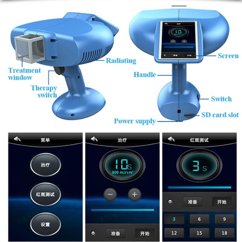 Peninsula Excimer Laser 308c Psoriasis Vitiligo Laser Machine