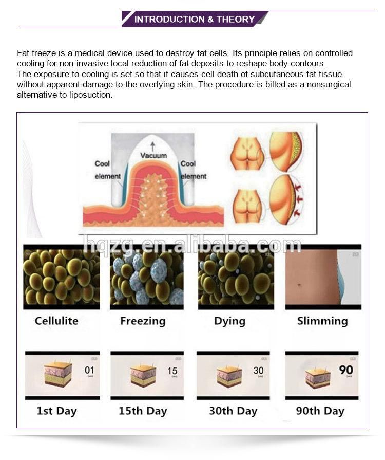 New Slimming Machine Combine Cryotherapy RF Cavitation in One Machine