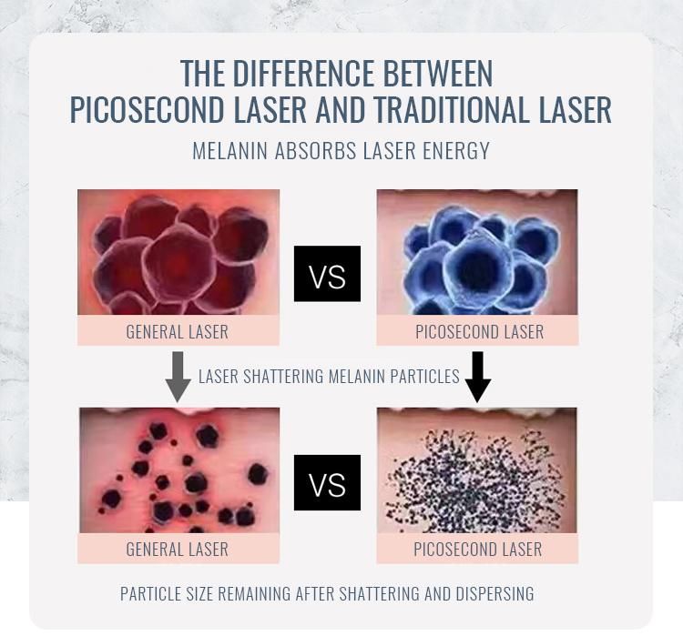 Picosecond Laser Anti-Pigmentation / Tattoo Removal Machine with Ce Approved