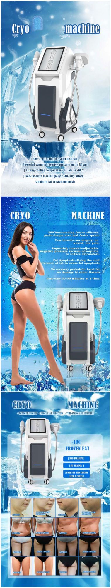 Large Handles 4D Cryolipolysis Fat Freezing Body Slimming Machine