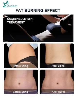 EMS Slim Machine for Aesthetic Center