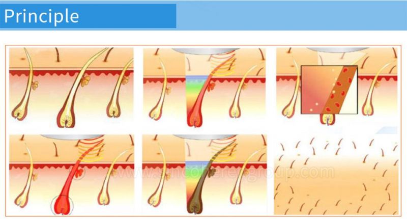 Jo. Multifunctional Painless Professional IPL Freckle Opt Skin Rejuvenation Hair Removal Machine with IPL Shr Opt Laser