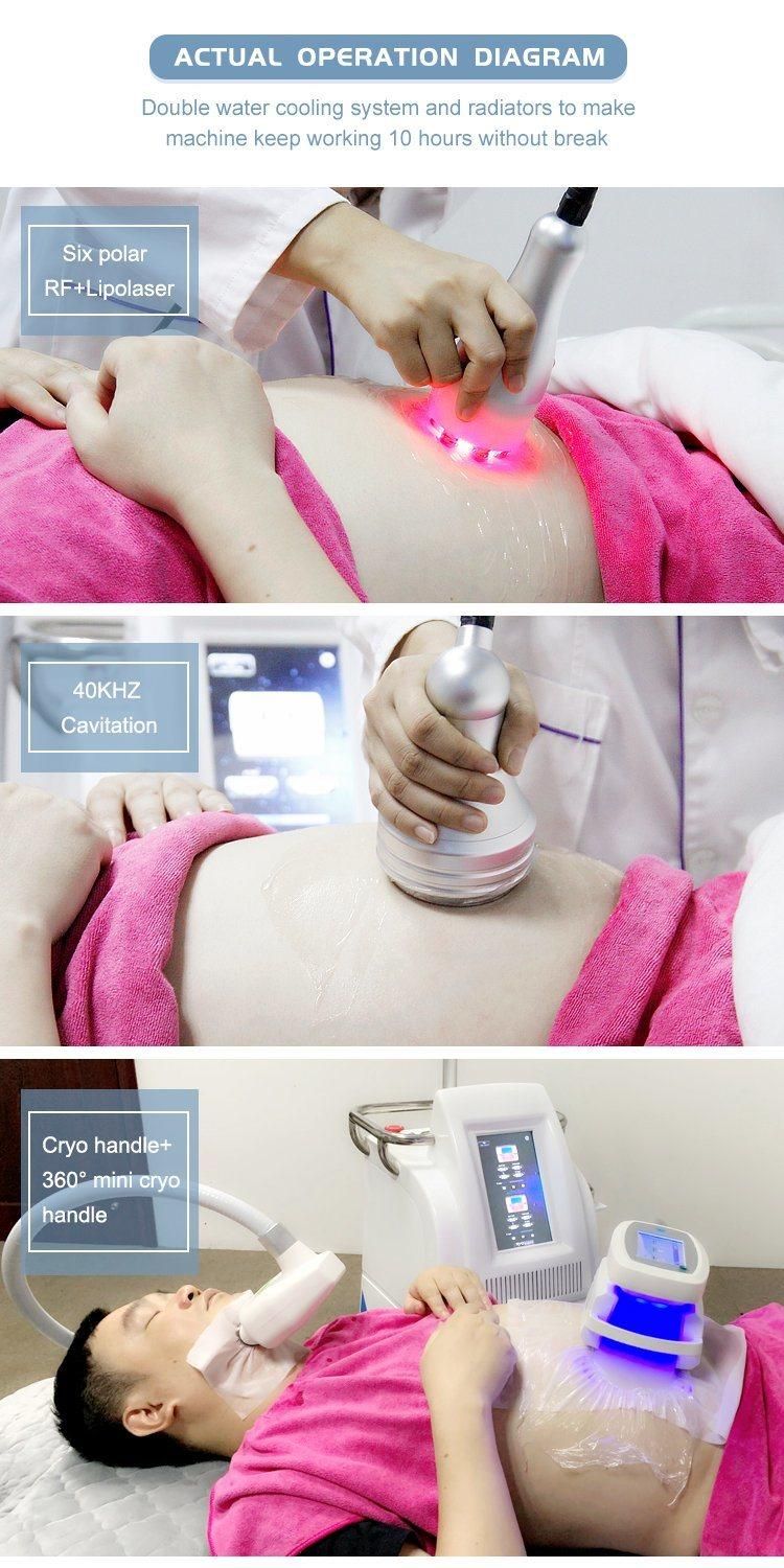 Cooling Fat to Loss Body Sculpting Cryolipolysis with Dual Handles Work Together